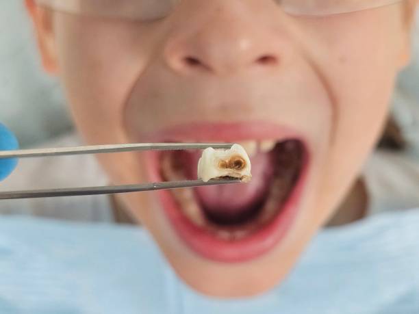 Best Emergency Dental Care for Trauma or Injury in Pleasant Hill, OH
