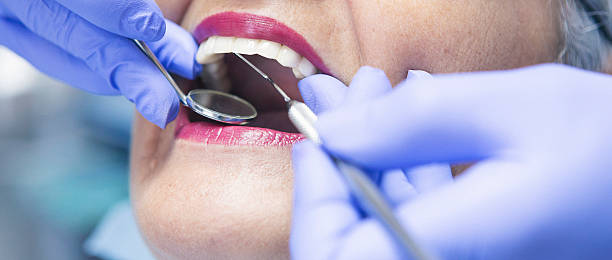 Best Same-Day Emergency Dentist in Pleasant Hill, OH